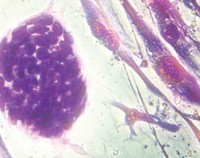 /album/fotogaleria/neurologo-neurologia-cerebro-0023-jpg1/